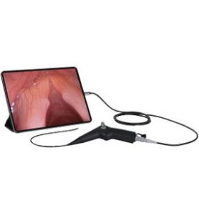 Video endoszkópok (Chip on the tip)