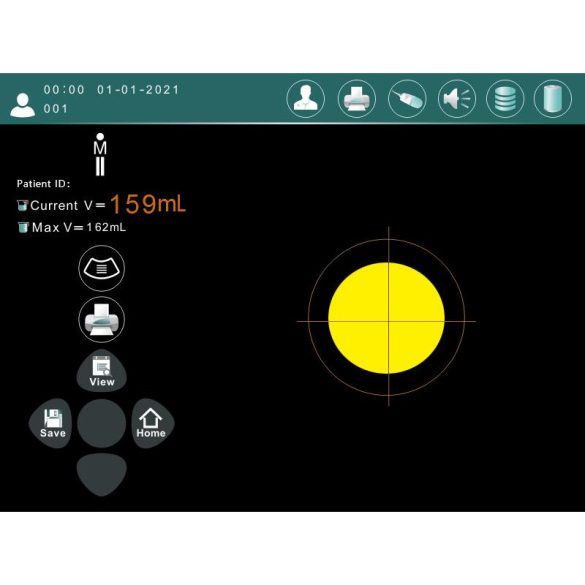 Ultrahangos hólyagvizsgáló 