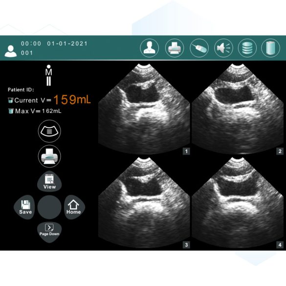 Ultrahangos hólyagvizsgáló 